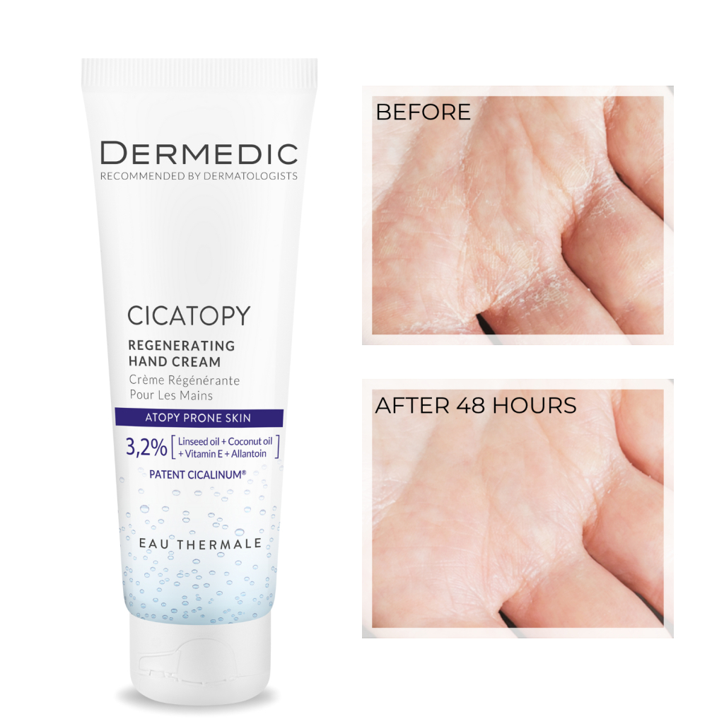 Крем для рук Dermedic Cicatopy Відновлювальний 75 мл (5901643176471)