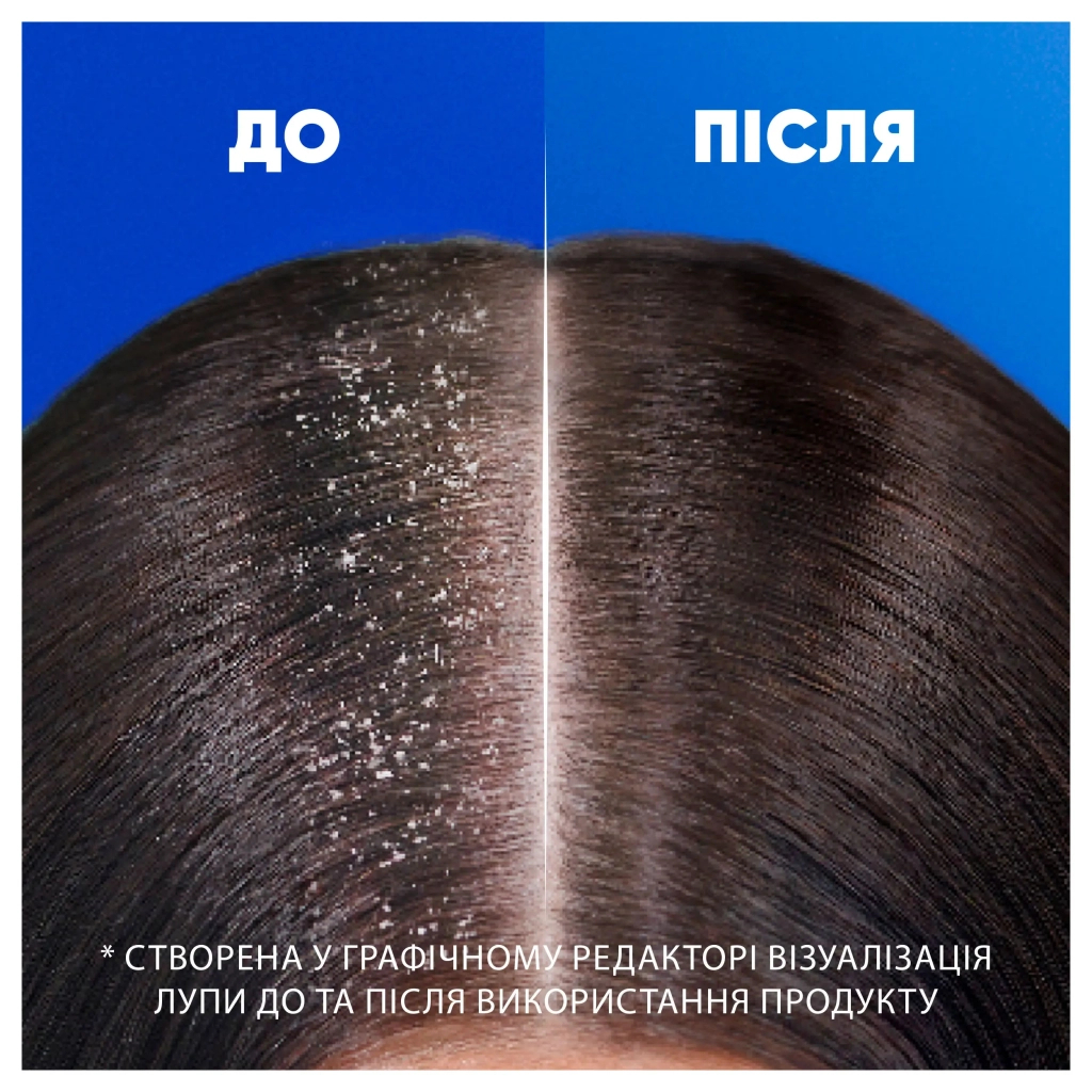 Шампунь Head & Shoulders Проти лупи Глибоке зволоження 250 мл (8700216605281)