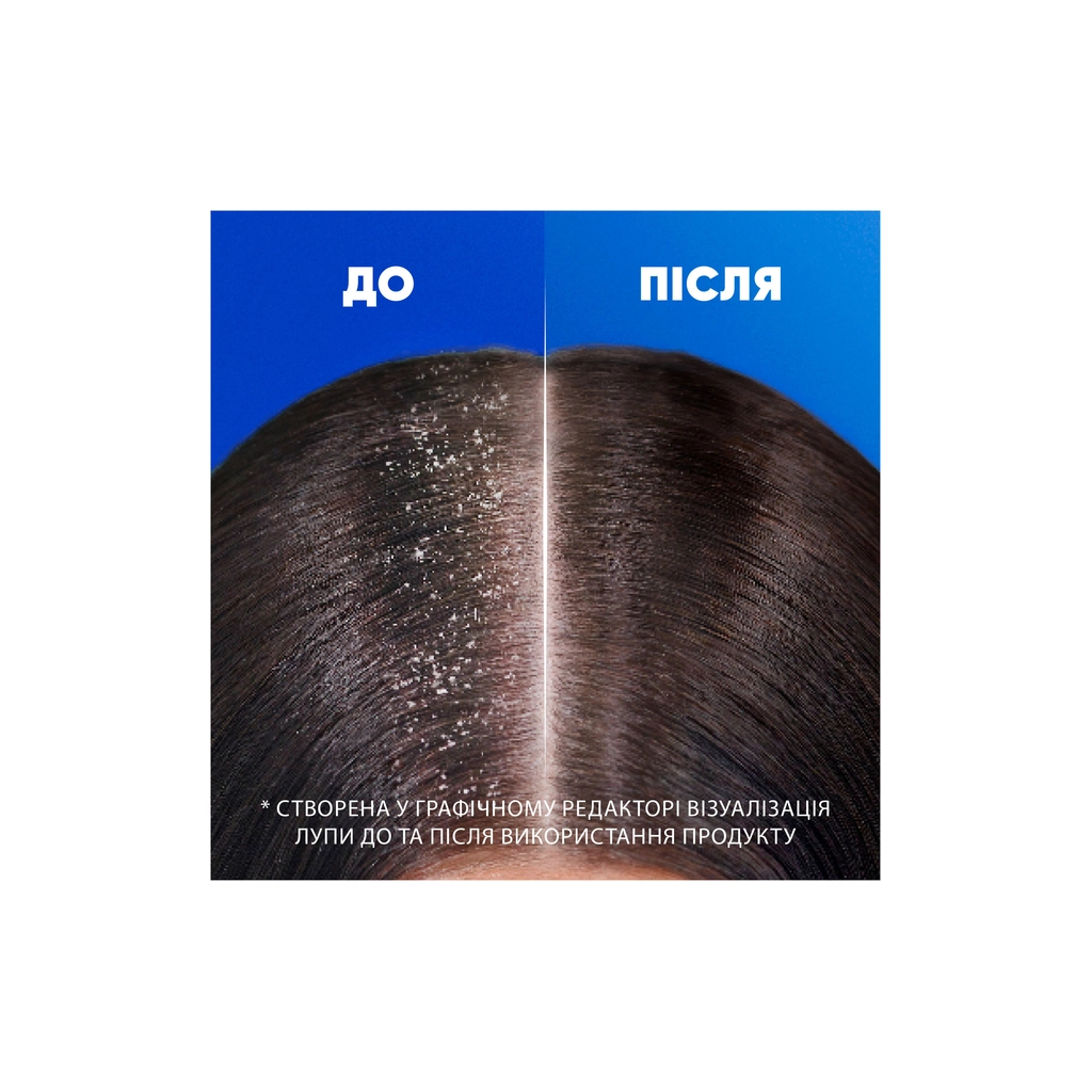 Шампунь Head & Shoulders Для чутливої шкіри 400 мл (5011321336124)