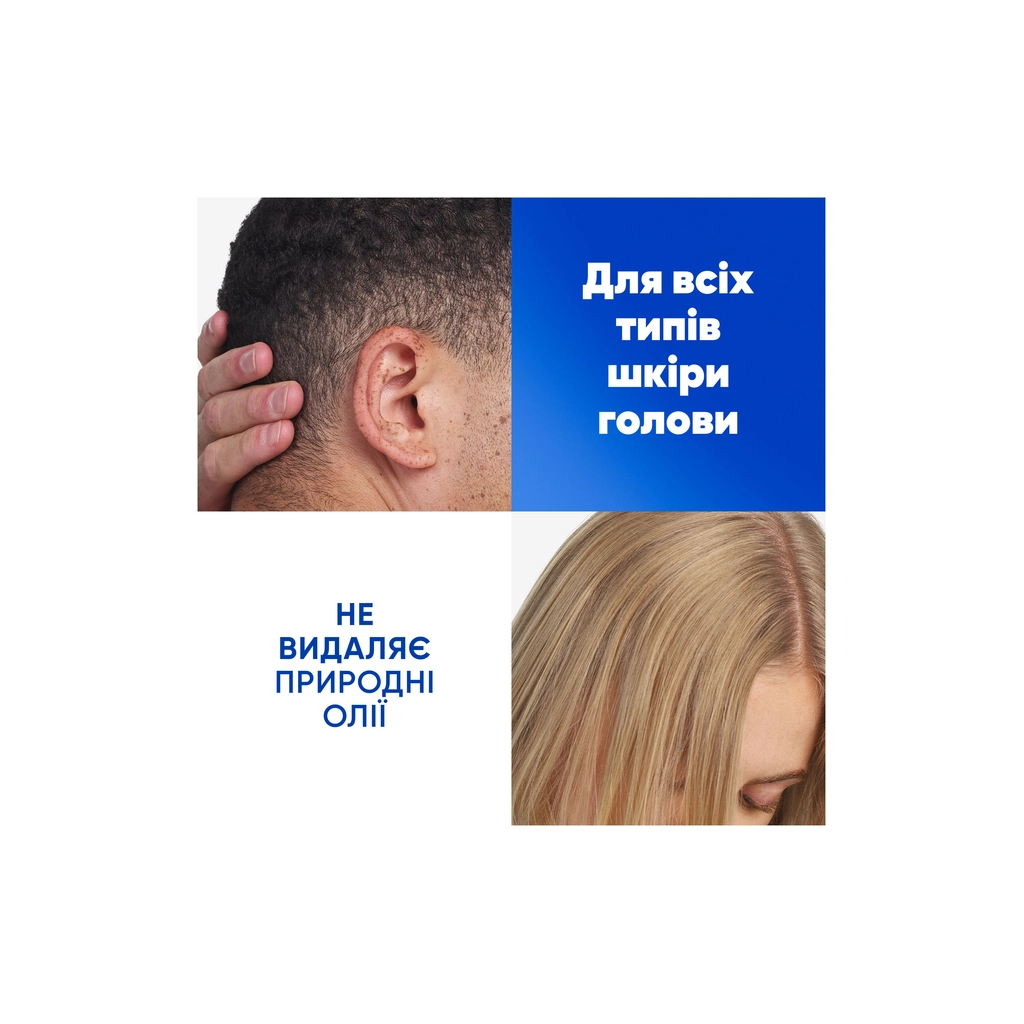 Шампунь Head & Shoulders Яблучна свіжість 400 мл (5410076659456)